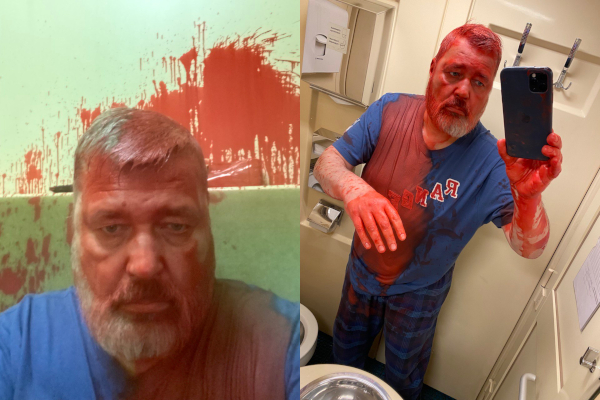 Dmitry Muratov's face covered in paint, after his 2022 attack. (Photos by Dmitry Muratov, courtesy Oxford Flms.)
